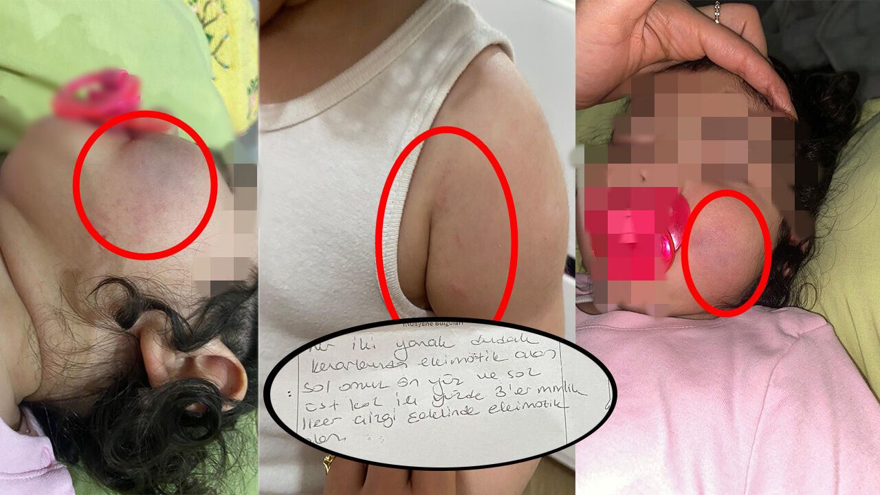 Anne Hayatının Şokunu Yaşadı! Eğitim Kurumunda Otizmli Miniğe Darp İddiası